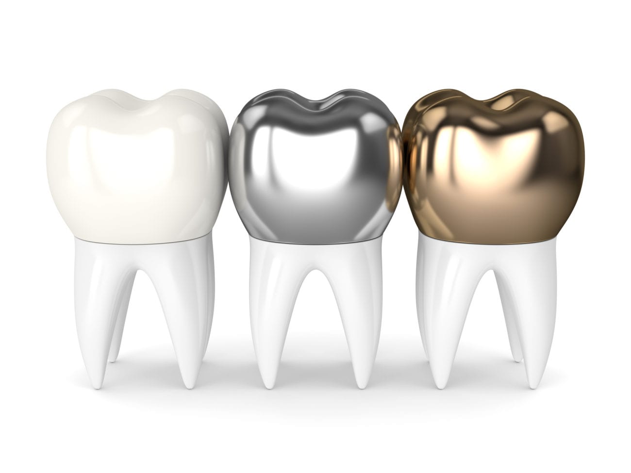 gold front tooth crown
